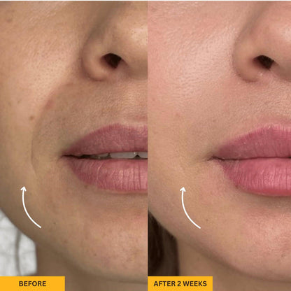 Lymphatic Face Sculpting Brush