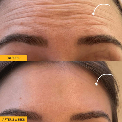 Lymphatic Face Sculpting Brush